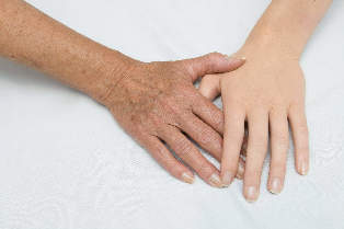 rajeunissement de la peau des mains
